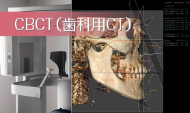 CBCT（歯科用CT）
